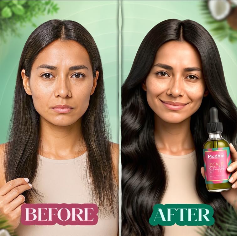 Madani Naturals Scalp Stimulator Hair Growth Oil with Rosemary Oil & Mint - Hair Loss Treatment for Split Ends and Dry Scalp, Strengthen Hair, 2 Fl Oz Avelisse