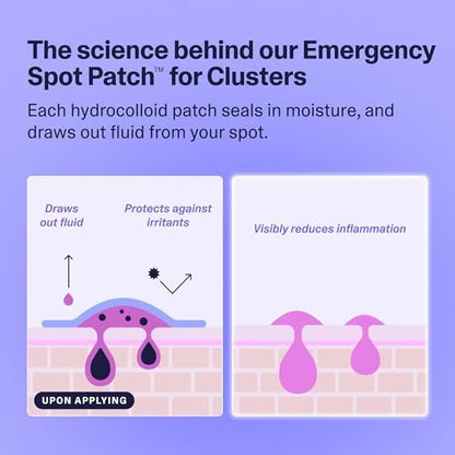 Curology Emergency Spot Patch Clusters for Breakouts - Fast Acting Large Hydrocolloid Pimple Patches for Face, Oil Absorbing, 14 Count Avelisse