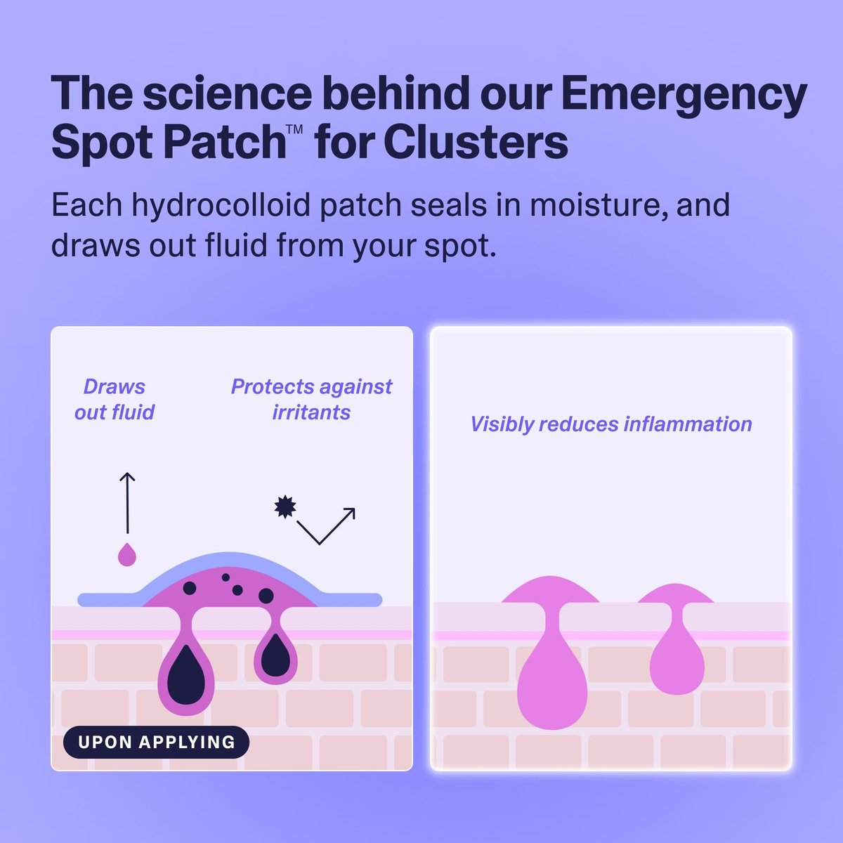Curology Emergency Spot Patch Clusters for Breakouts - Fast Acting Large Hydrocolloid Pimple Patches for Face, Oil Absorbing, 14 Count Avelisse
