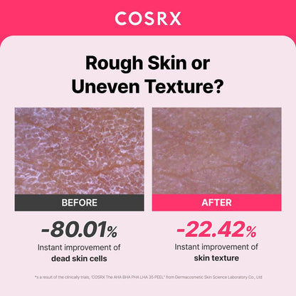 COSRX AHA BHA PHA LHA 35% Peel – Chemical Exfoliating Peeling Gel for Dull, Rough, Oily Skin, 1.01 fl. oz / 30 ml Avelisse