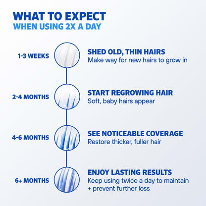 Rogaine Men's 5% Minoxidil Foam Hair Regrowth Treatment, Extra Strength, Unscented, 4 Month Supply (4 x 2.11 oz Cans) Avelisse