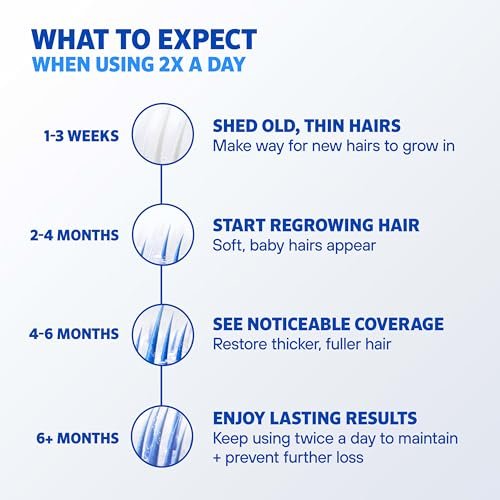 Rogaine Men's 5% Minoxidil Foam Hair Regrowth Treatment, Extra Strength, Unscented, 4 Month Supply (4 x 2.11 oz Cans) Avelisse