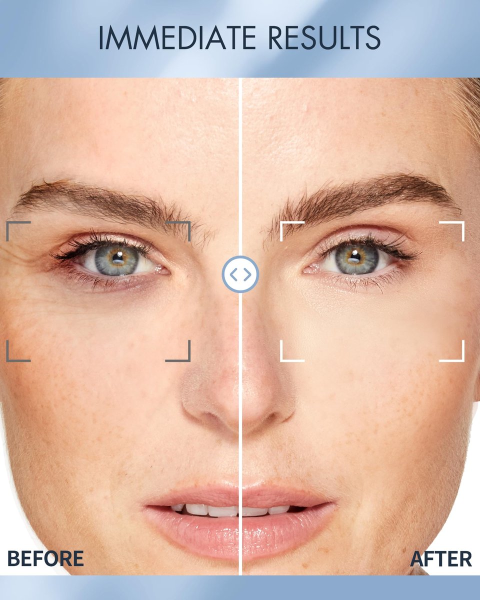 depology Replenish & Repair Under Eye Patches for Puffy Eyes and Wrinkles (60 Patches) – Hydrating Eye Gel Pads with Ceramides and Hyaluronic Acid for All Skin Types Avelisse