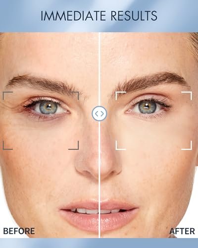 depology Replenish & Repair Under Eye Patches for Puffy Eyes and Wrinkles (60 Patches) – Hydrating Eye Gel Pads with Ceramides and Hyaluronic Acid for All Skin Types Avelisse