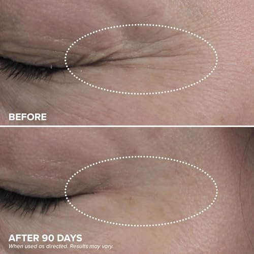 DRMTLGY HPR Eye Cream - Retinoid Under Eye Cream for Under Eyes, 0.5 fl oz Avelisse