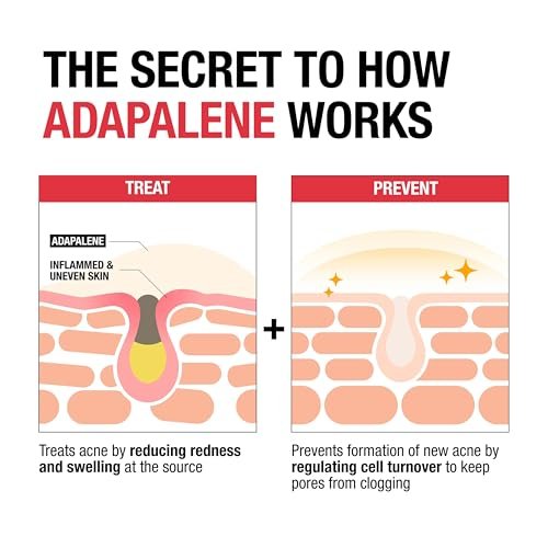 Neutrogena 0.1% Adapalene Gel Acne Treatment - Daily Retinoid for Clear Skin, Oil & Fragrance-Free, 1.6 oz Avelisse