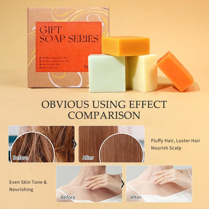 Yeokoe Turmeric Soap Bar and Rice Water Shampoo Conditioner Bar Set – Deep Cleansing Kojic Acid Soap for Body, Face, and Hair – Travel Toiletries & Spa Gifts for Women