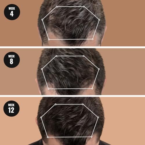 Superior Mane Root Activator & Hair Growth Conditioner for Men - Thickening Conditioner for Stronger Follicles, Healthy Roots & Scalp (250ml) - görsel 4