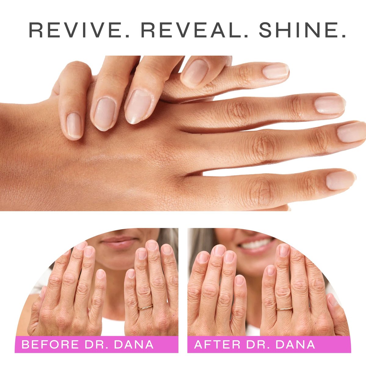 Dr. Dana Nail Repair Kit for Damaged Nails - Strengthening & Exfoliating Treatment with Glycolic Acid, Nail Primer, Hydrator & Priming Wand for Shiny, Healthy Nails Avelisse
