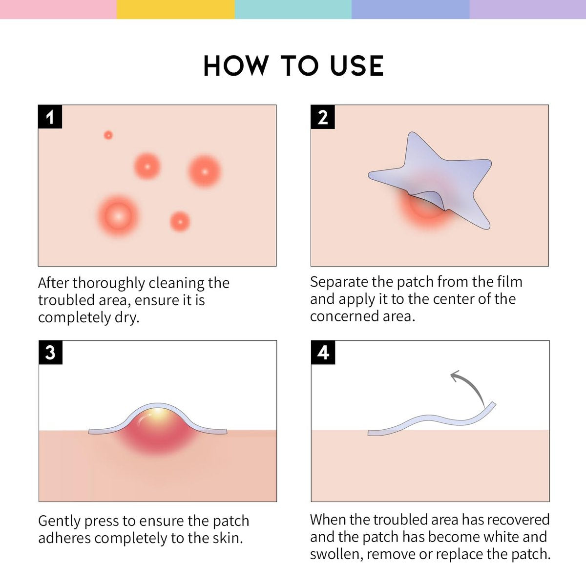 #OOTD Star Pimple Patches – Hydrocolloid Acne Spot Treatment with Niacinamide & Ceramide, Cute Pastel Colors, K-Beauty Skincare for Face, 80 Count Avelisse