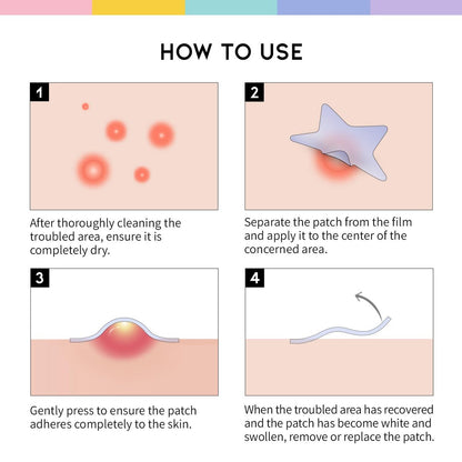 #OOTD Star Pimple Patches – Hydrocolloid Acne Spot Treatment with Niacinamide & Ceramide, Cute Pastel Colors, K-Beauty Skincare for Face, 80 Count Avelisse