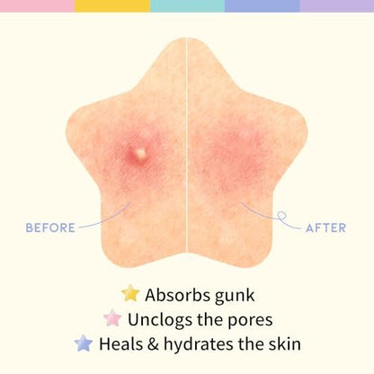 #OOTD Star Pimple Patches – Hydrocolloid Acne Spot Treatment with Niacinamide & Ceramide, Cute Pastel Colors, K-Beauty Skincare for Face, 80 Count Avelisse