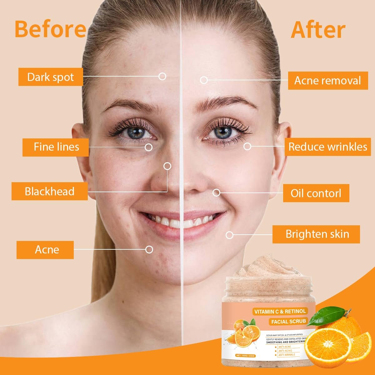IREV Vitamin C Face Scrub – Exfoliating Facial Wash with Retinol, Deep Cleansing for Women & Men, 3.53 oz - görsel 3
