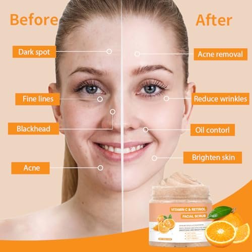 IREV Vitamin C Face Scrub – Exfoliating Facial Wash with Retinol, Deep Cleansing for Women & Men, 3.53 oz - görsel 4