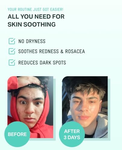 BRING GREEN ZINC TECA Serum with Niacinamide | Soothing Face Serum for Sensitive Skin, Pore Minimizing & Hydrating | Korean Skincare for Breakouts & Uneven Texture - görsel 9