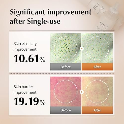 UIQ Biome Barrier Cream Mist - Microbiome-Powered Face Mist with Hyaluronic Acid & Niacinamide, Deep Hydration, Glow & Soothing, Korean Skin Care, 100ml / 3.38 fl. oz. Avelisse