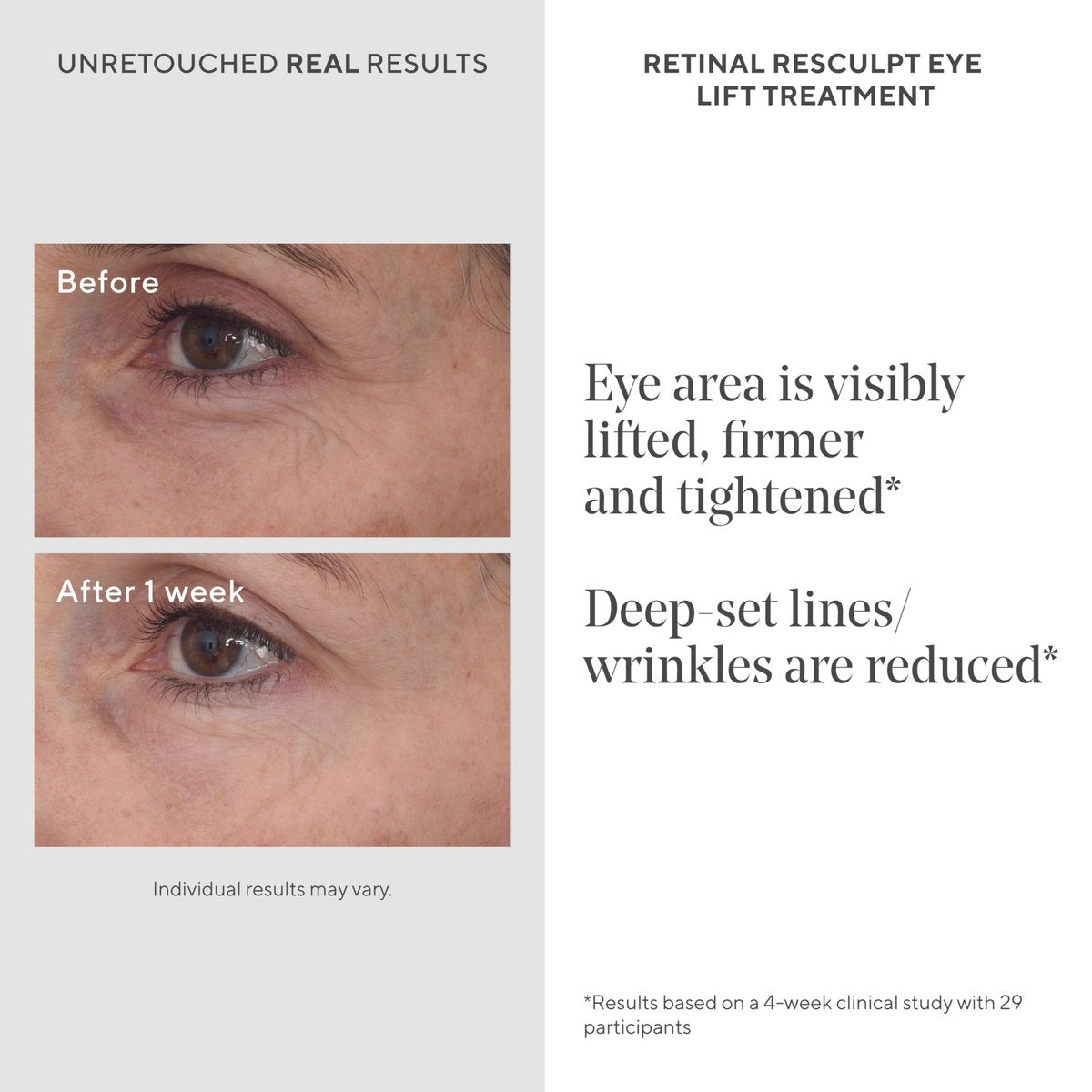Murad Retinal ReSculpt Eye Lift Treatment - Age-Defying Eye Cream with Encapsulated Retinal, Gentian Root & Oat-Firming Film for Youthful Eyes - Tightens Droopy Lids & Under-Eye Bags - 0.5 Fl Oz Avelisse