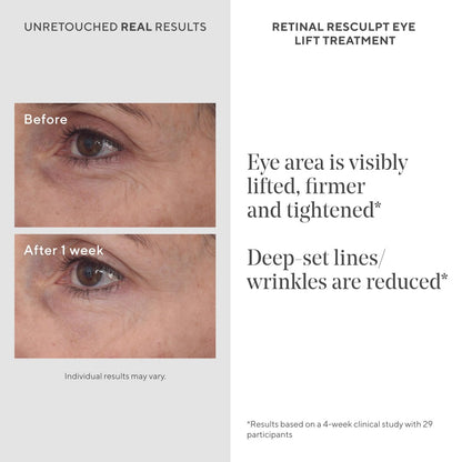 Murad Retinal ReSculpt Eye Lift Treatment - Age-Defying Eye Cream with Encapsulated Retinal, Gentian Root & Oat-Firming Film for Youthful Eyes - Tightens Droopy Lids & Under-Eye Bags - 0.5 Fl Oz Avelisse