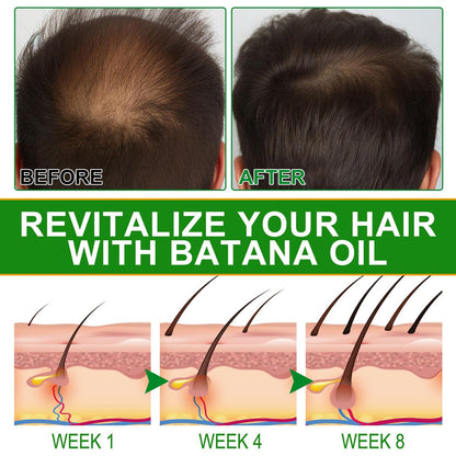VXHDAG Batana Oil for Hair Growth and Nourishment - 2.02 fl oz with Scalp Massager, Pure & Natural for Split Ends and Radiant Skin Avelisse