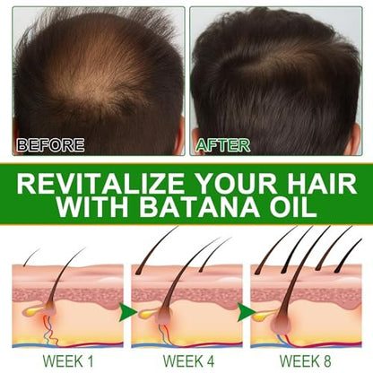 VXHDAG Batana Oil for Hair Growth and Nourishment - 2.02 fl oz with Scalp Massager, Pure & Natural for Split Ends and Radiant Skin Avelisse