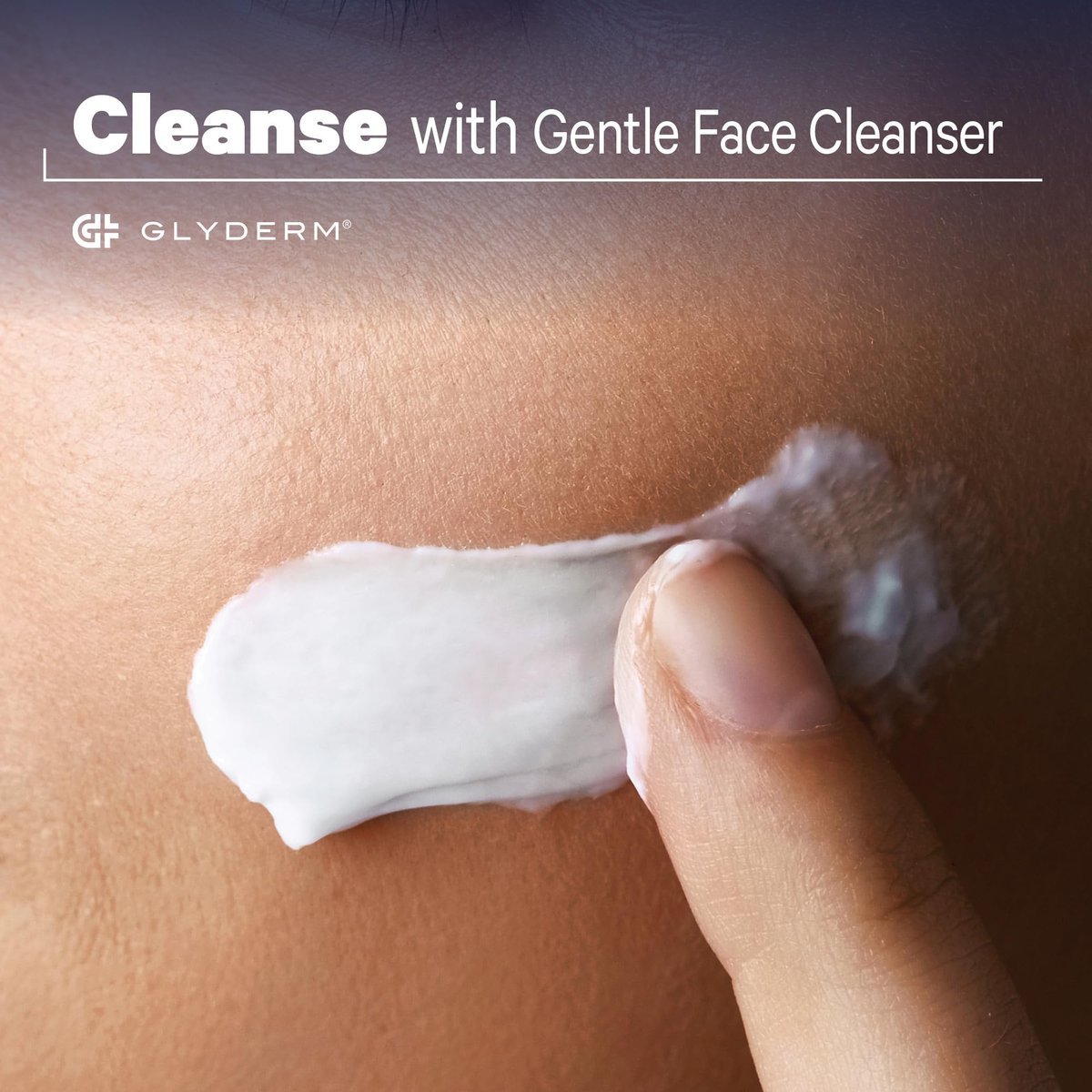 GlyDerm Gentle Face Cleanser - Soap-Free Concentrated Cleanser with 0.2% Esterified Glycolic Acid - Gentle Exfoliating Face Wash for All Skin Types - 7 oz Pump Avelisse