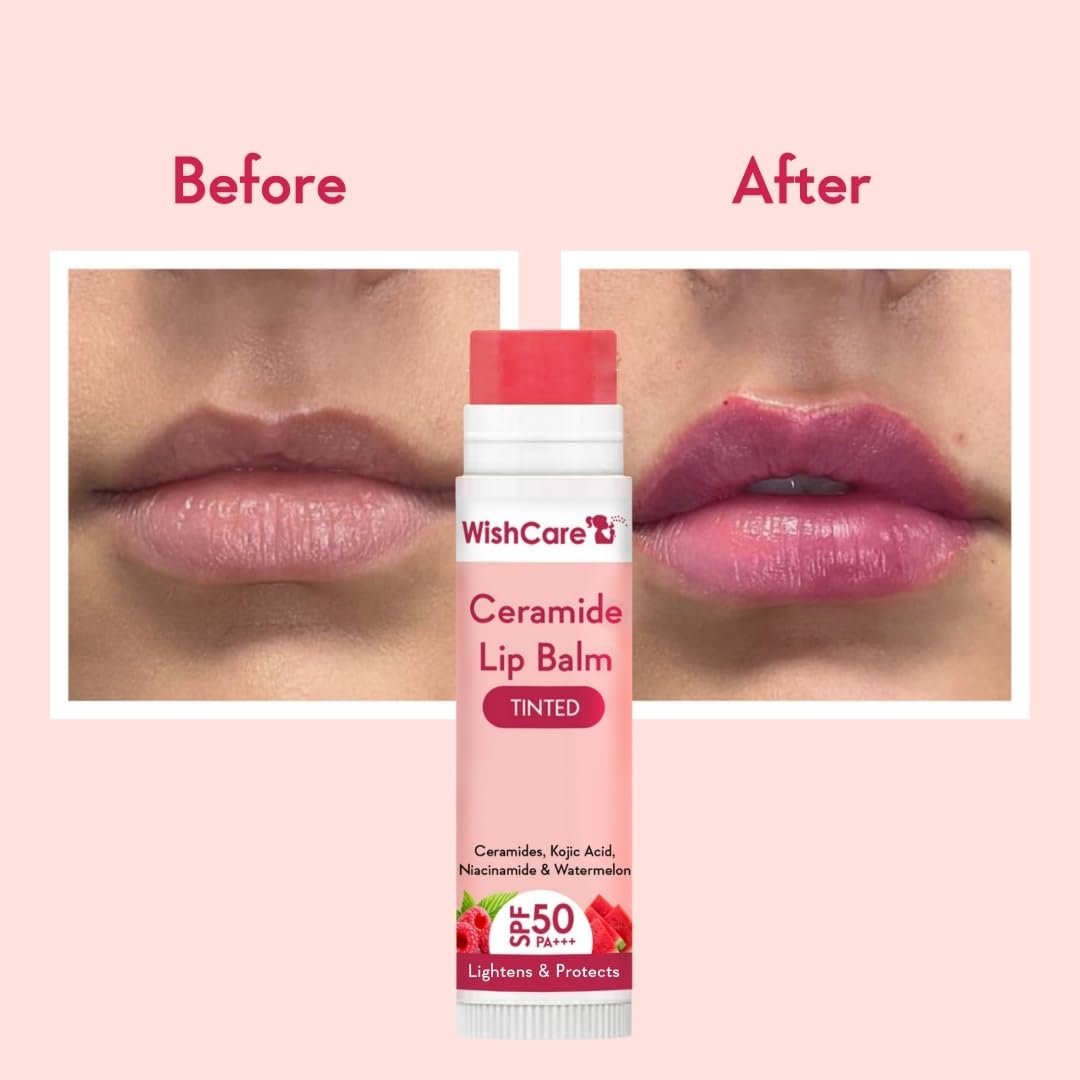WishCare Tinted Lip Balm with SPF 50 PA+++ – Enriched with Niacinamide, Natural Pink, 5g - görsel 5