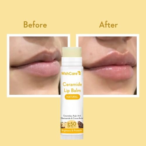 WishCare Lip Balm with SPF 50 PA+++ – Niacinamide Lip Care for Men & Women, 5g - görsel 6