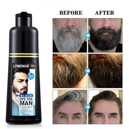 Natural Black Mustache & Beard Dye for Gray Hair Coverage – Fast 5-Minute Application, Easy Shampoo for Facial Hair, 6.76 Fl Oz Avelisse