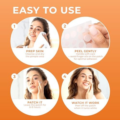 PatchRx Pimple Patches for Face (240 Count) - Hydrocolloid Acne Patches, Zit Stickers for Overnight Spot Treatment Avelisse