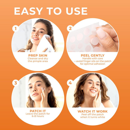 PatchRx Pimple Patches for Face (240 Count) - Hydrocolloid Acne Patches, Zit Stickers for Overnight Spot Treatment Avelisse