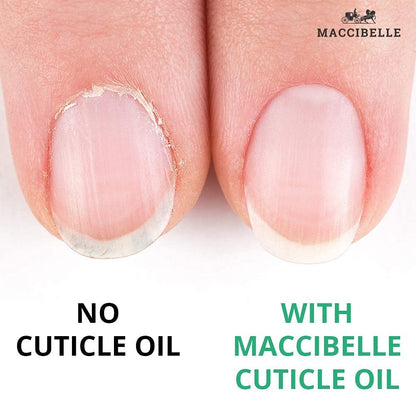 Maccibelle Cuticle Oil for Dry Cracked Cuticles - Refill Size, 4 oz, Pineapple Scent
