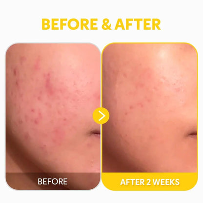 TIRTIR Pure Vitamin C 24% Face Serum – Dark Spot Remover for Sensitive Skin with Collagen, Anti-Aging, Even Out Skin Tone, Non-Irritation Tested, Korean Mild Vita C Facial Serum, 1.01 Fl Oz Avelisse