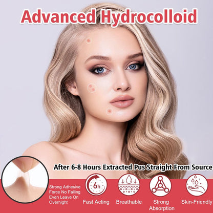 450 Pimple Patches for Face, Hydrocolloid Acne Patches, Invisible Zit Covers, 4 Sizes