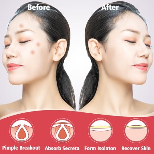 450 Pimple Patches for Face, Hydrocolloid Acne Patches, Invisible Zit Covers, 4 Sizes - görsel 4