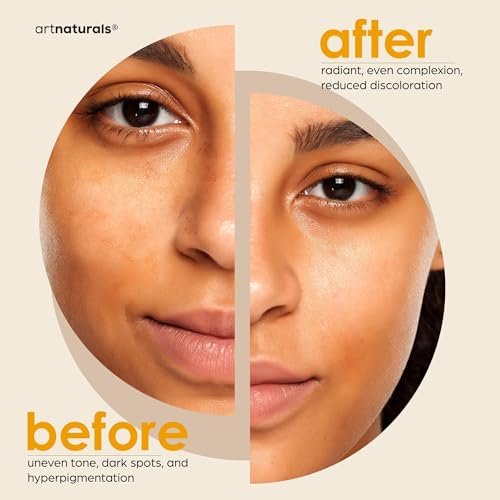 Artnaturals Kojic Acid & Turmeric Dark Spot Remover Soap Bars with Vitamin C, Retinol, Collagen & Shea Butter - Original Japanese Complex Infused with Hyaluronic Acid - Includes African Net Sponge, 2 Pack - görsel 8