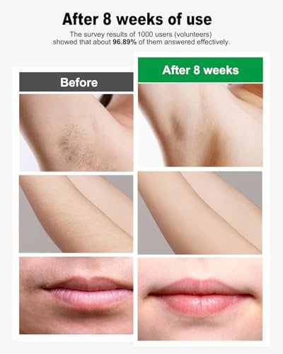 MEUKPE IPL Hair Removal Device AI06 - Permanent Hair Removal for Face, Legs, Arms & Bikini Line - Green Avelisse