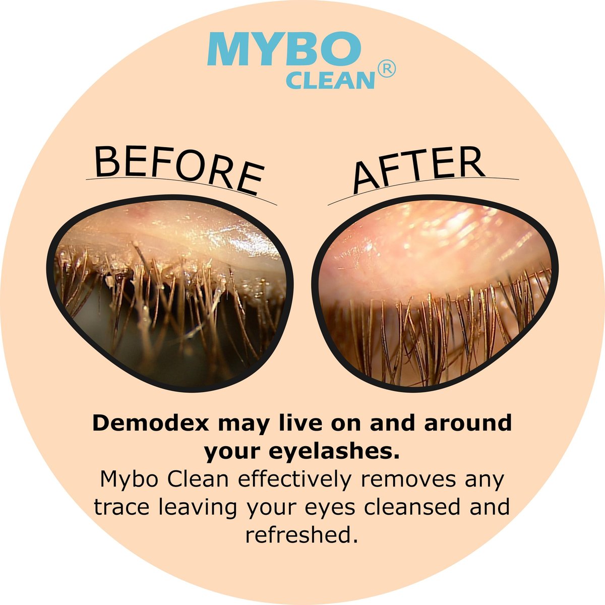 Mybo Clean Eyelid Cleansing Brush for Sensitive Skin + Hydrating Lids & Lash Cleansing Gel + Travel Bag – Gentle Eye Care Set Avelisse