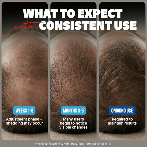 Kirkland Minoxidil Liquid Extra Strength Hair Regrowth Treatment for Men, 5% Topical Solution, 6 Months Supply with Dropper Applicator and Bonus Guide Avelisse