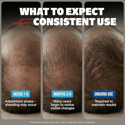 Kirkland Minoxidil Liquid Extra Strength Hair Regrowth Treatment for Men, 5% Topical Solution, 6 Months Supply with Dropper Applicator and Bonus Guide Avelisse