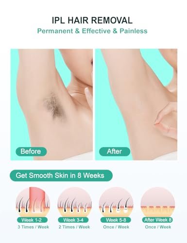 AUITRONCARE At-Home IPL Laser Hair Removal Device - 999,999 Flashes Painless Hair Remover for Women and Men, Permanent Hair Reduction on Armpits, Back, Legs, Arms, Face, Bikini Line Avelisse