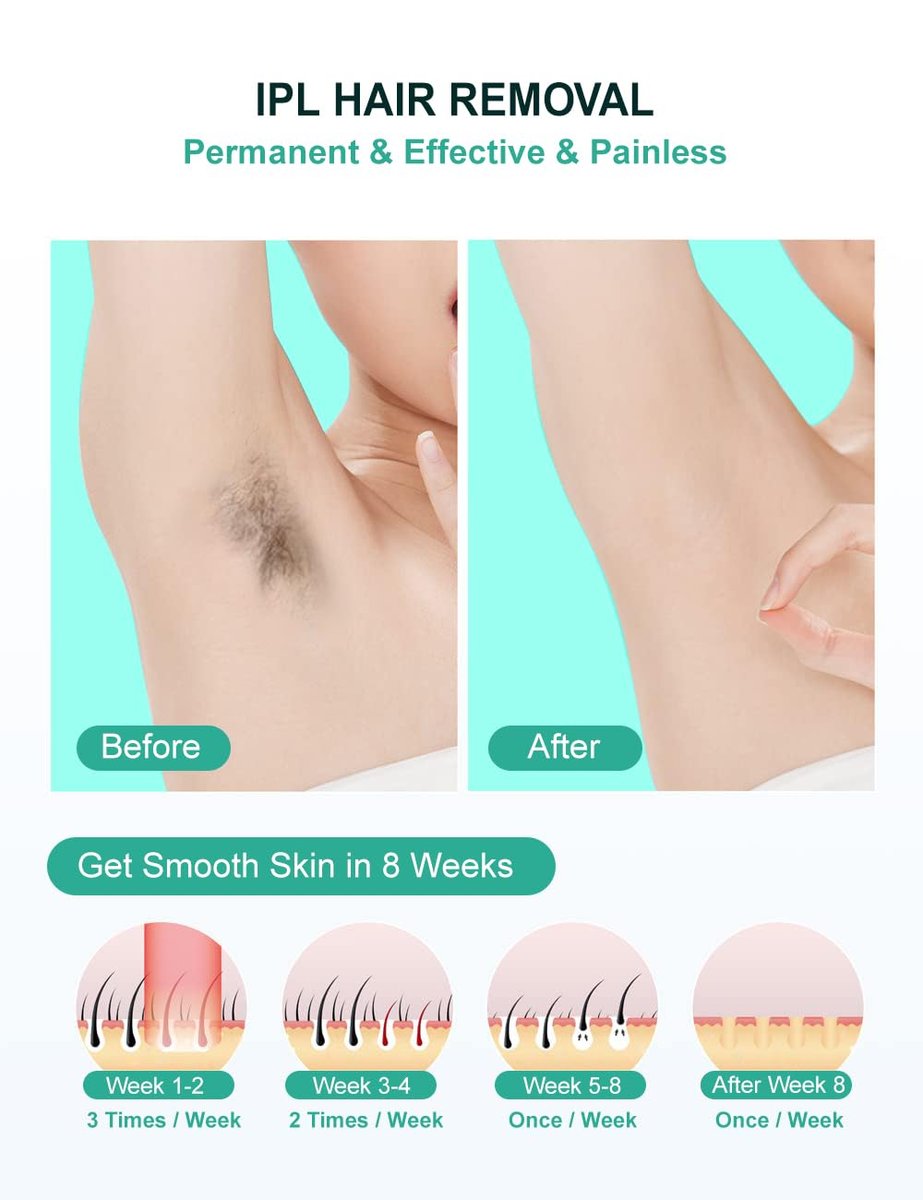 AUITRONCARE At-Home IPL Laser Hair Removal Device - 999,999 Flashes Painless Hair Remover for Women and Men, Permanent Hair Reduction on Armpits, Back, Legs, Arms, Face, Bikini Line Avelisse