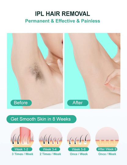 AUITRONCARE At-Home IPL Laser Hair Removal Device - 999,999 Flashes Painless Hair Remover for Women and Men, Permanent Hair Reduction on Armpits, Back, Legs, Arms, Face, Bikini Line Avelisse