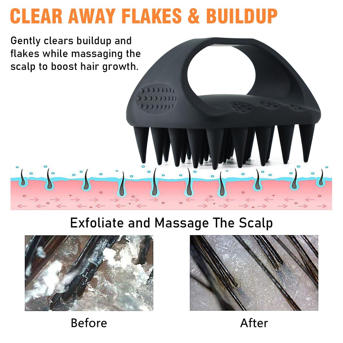 YEALIR Scalp Massager Shampoo Brush | 100% Silicone Scalp Scrubber for Dandruff & Build Up | Plastic Free Hair Growth Massager - görsel 5
