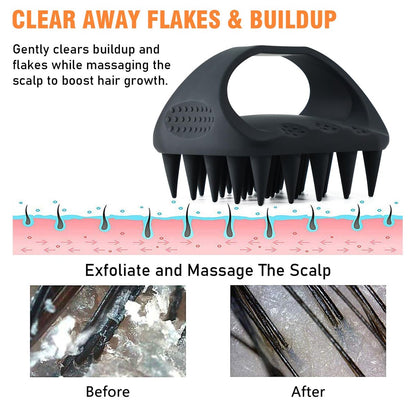 YEALIR Scalp Massager Shampoo Brush | 100% Silicone Scalp Scrubber for Dandruff & Build Up | Plastic Free Hair Growth Massager