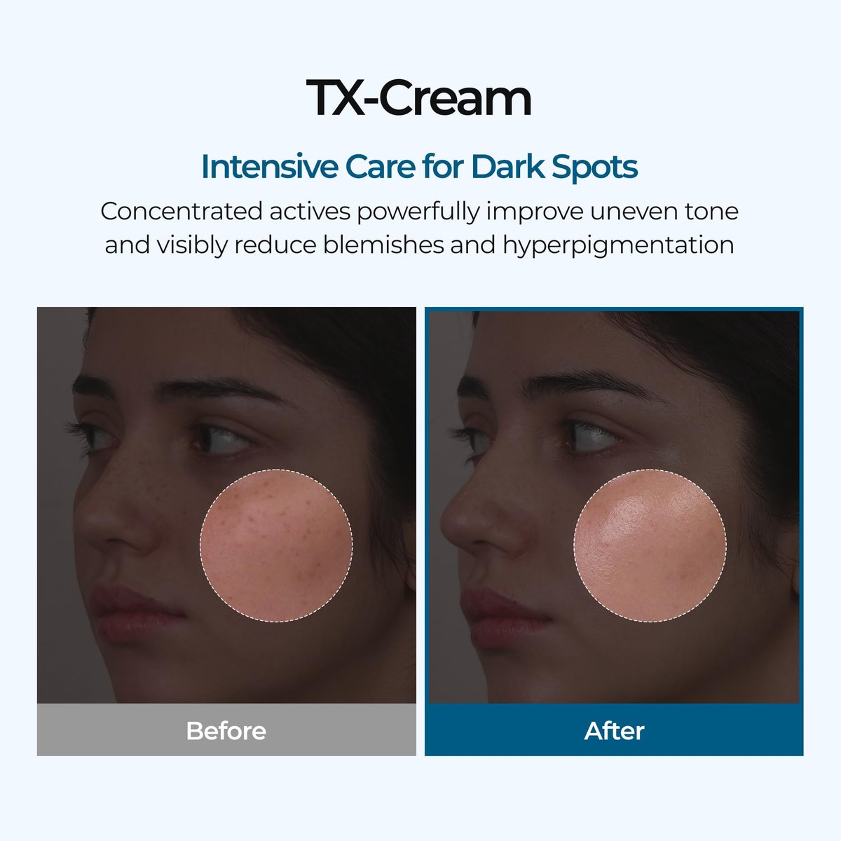 DR.Melaxin TX Tranexamic Acid Cream - Anti-Pigmentation & Freckle Cream for Even Skin Tone, Korean Skincare, 1.7 fl oz (50 ml) - görsel 3
