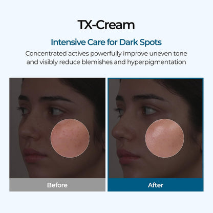 DR.Melaxin TX Tranexamic Acid Cream - Anti-Pigmentation & Freckle Cream for Even Skin Tone, Korean Skincare, 1.7 fl oz (50 ml)
