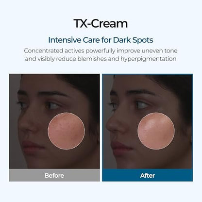 DR.Melaxin TX Tranexamic Acid Cream - Anti-Pigmentation & Freckle Cream for Even Skin Tone, Korean Skincare, 1.7 fl oz (50 ml)
