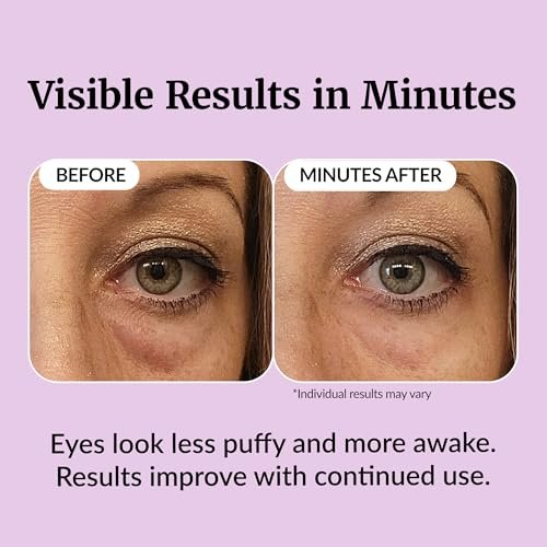 Vibriance Eye Renewal Serum for Mature Skin - Dark Circles, Puffiness & Fine Lines Treatment with Caffeine & Hyaluronic Acid Avelisse