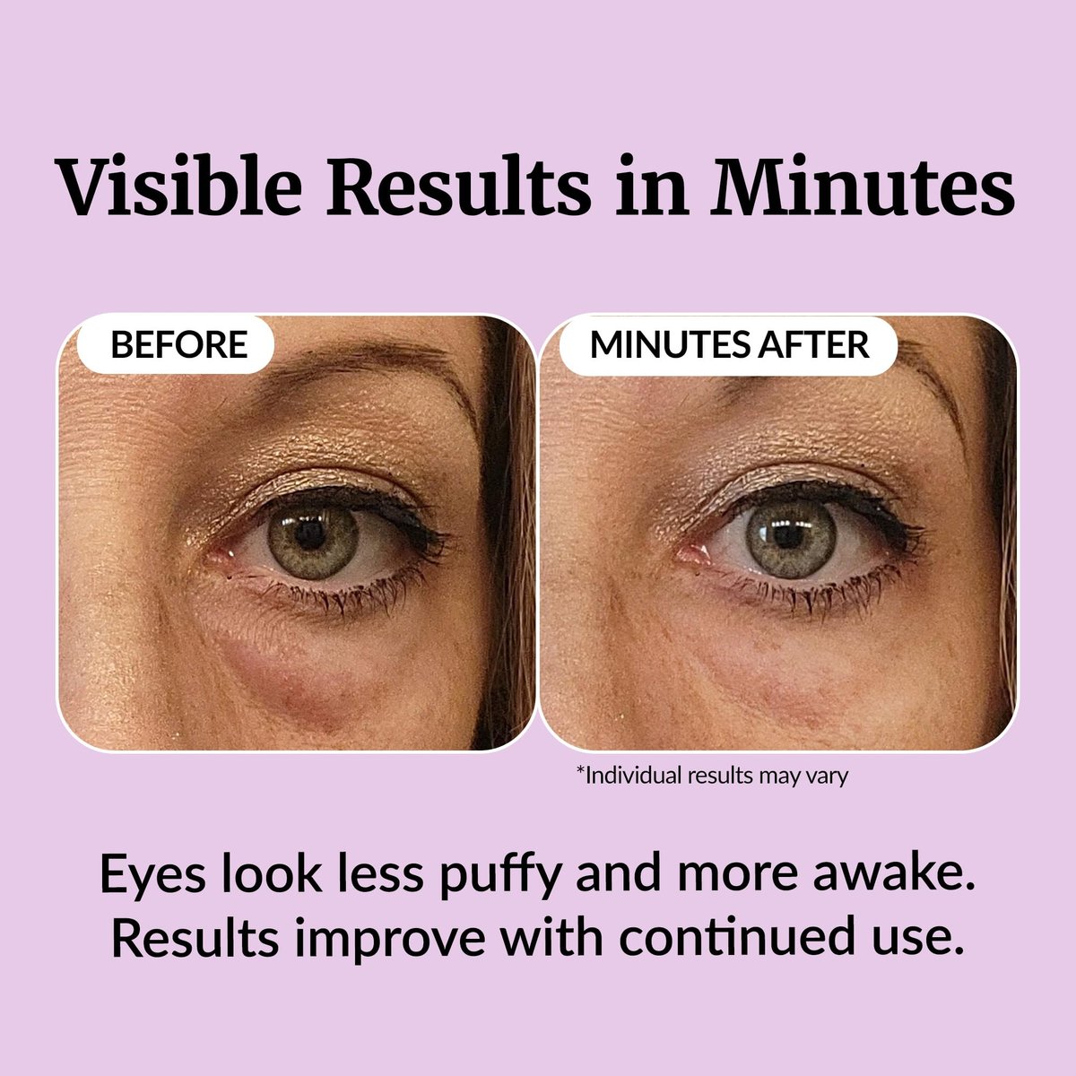 Vibriance Eye Renewal Serum for Mature Skin - Dark Circles, Puffiness & Fine Lines Treatment with Caffeine & Hyaluronic Acid Avelisse
