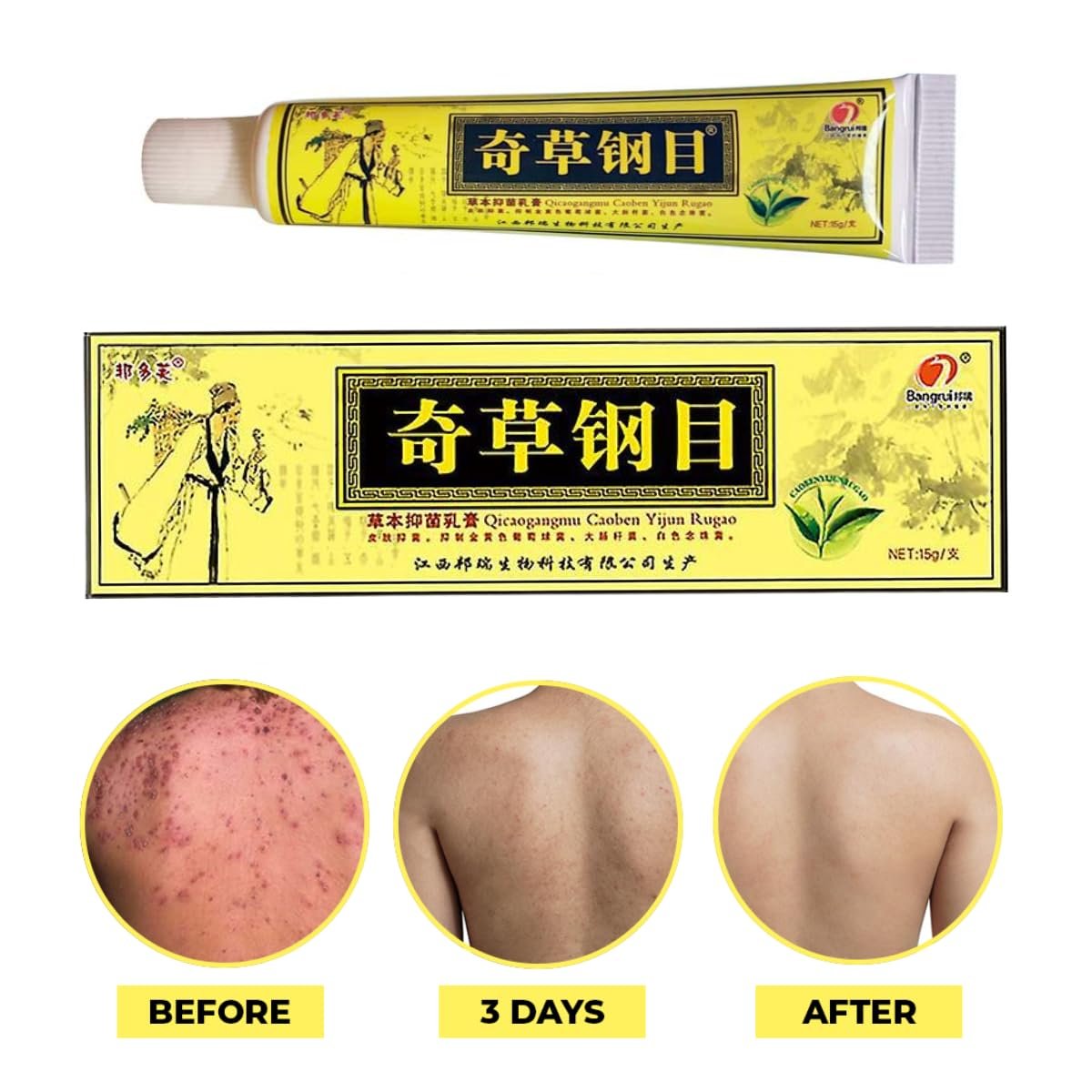 QICAOGANGMU Chinese Herbal Cream - Steroid Free Natural Relief for Skin Issues - Pack of 3 Avelisse